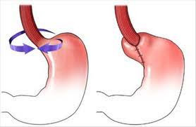 Cirurgia